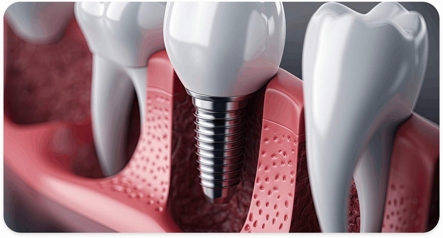 Prosthodontics